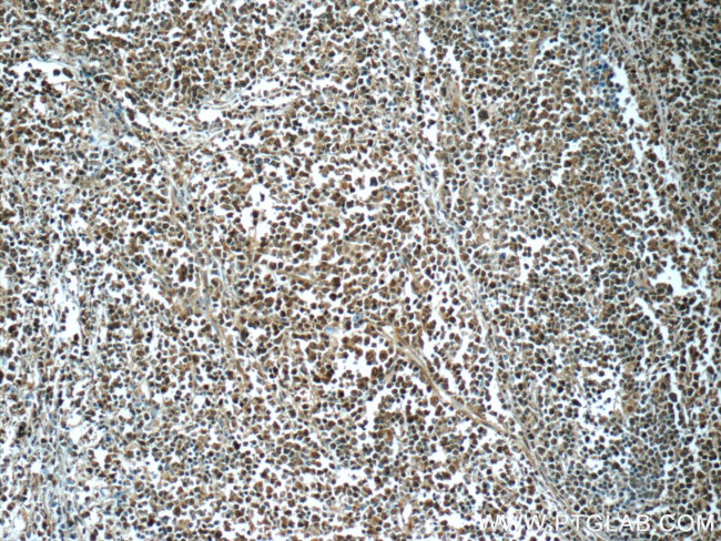 CSE1L Antibody in Immunohistochemistry (Paraffin) (IHC (P))