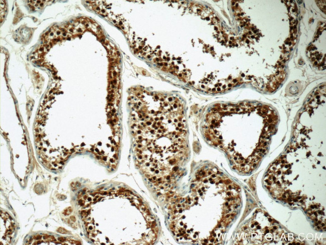 CSE1L Antibody in Immunohistochemistry (Paraffin) (IHC (P))