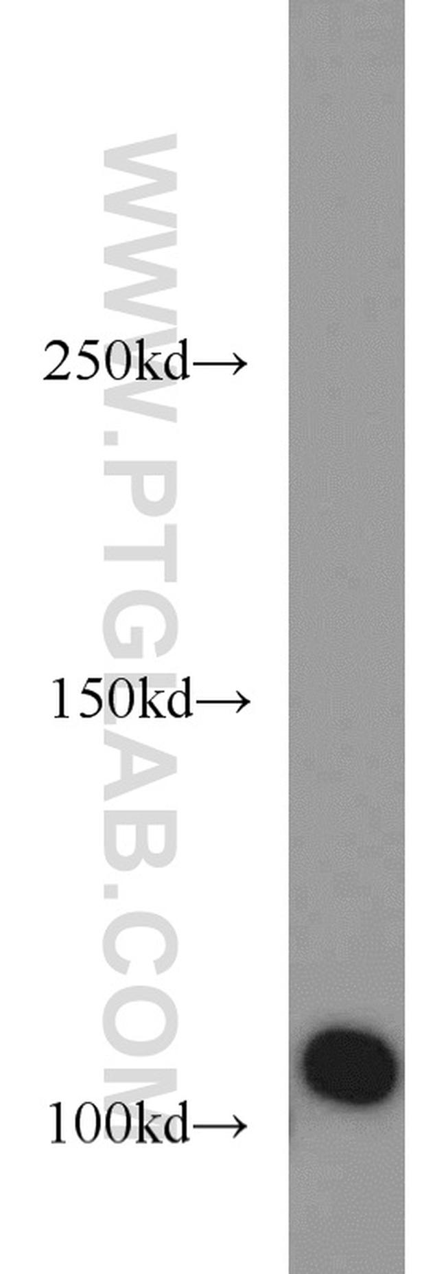 CSE1L Antibody in Western Blot (WB)