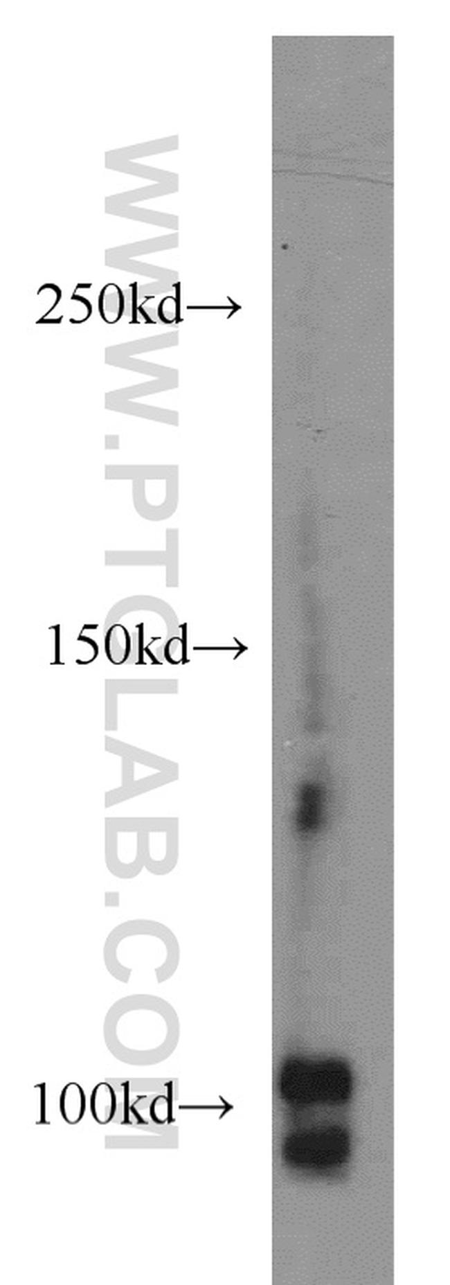 CSE1L Antibody in Western Blot (WB)