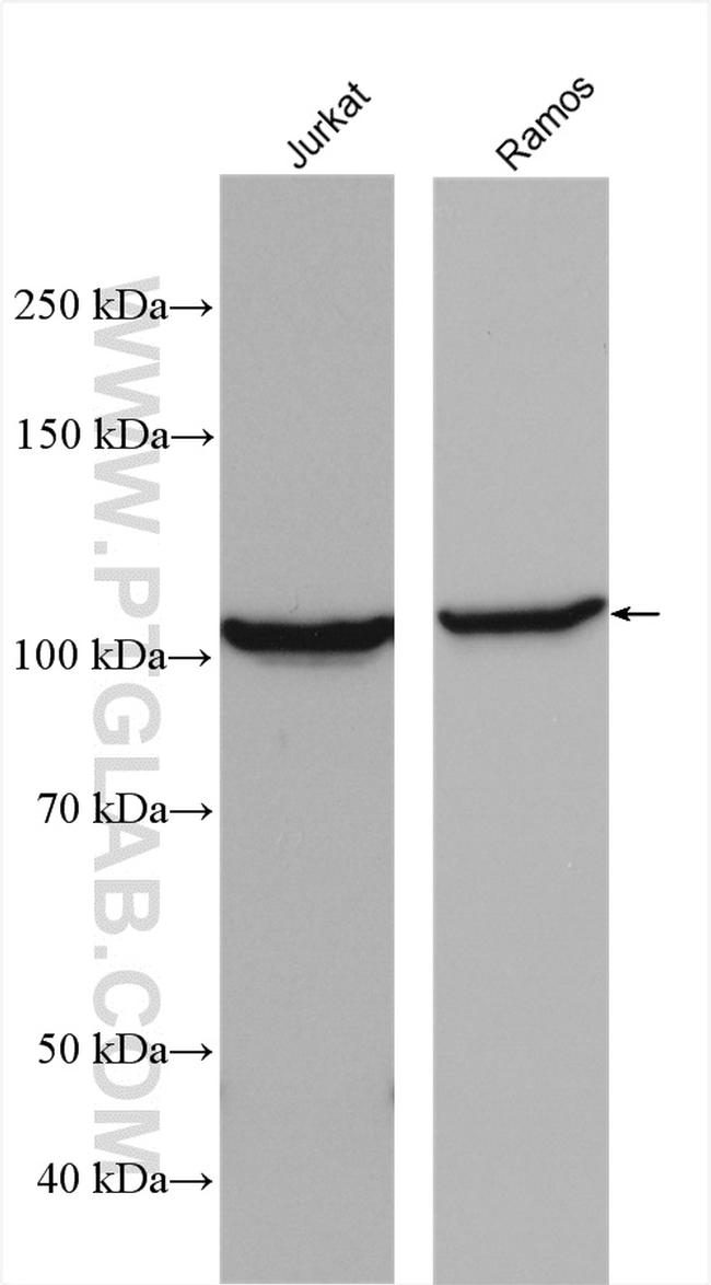 CSE1L Antibody in Western Blot (WB)