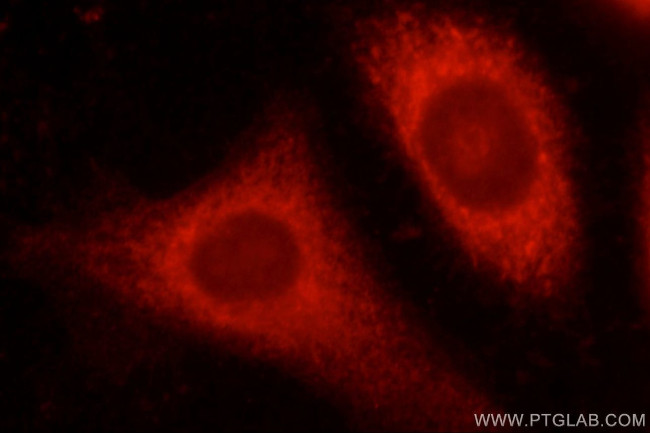 ALDH1B1 Antibody in Immunocytochemistry (ICC/IF)