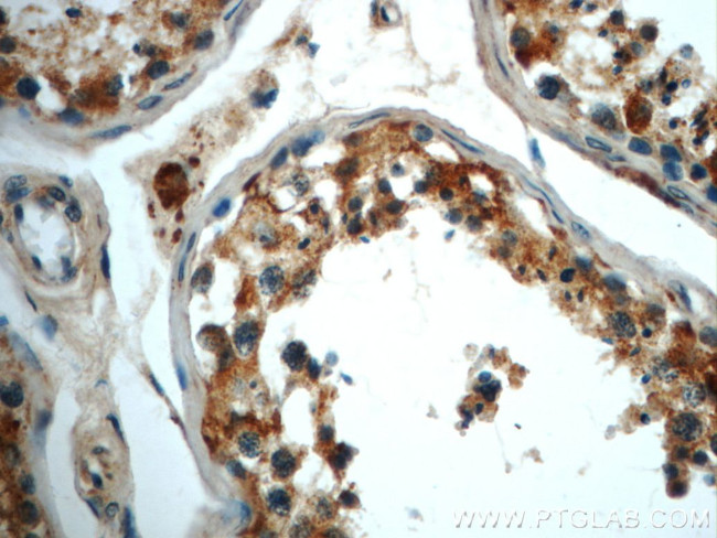 ALDH1B1 Antibody in Immunohistochemistry (Paraffin) (IHC (P))