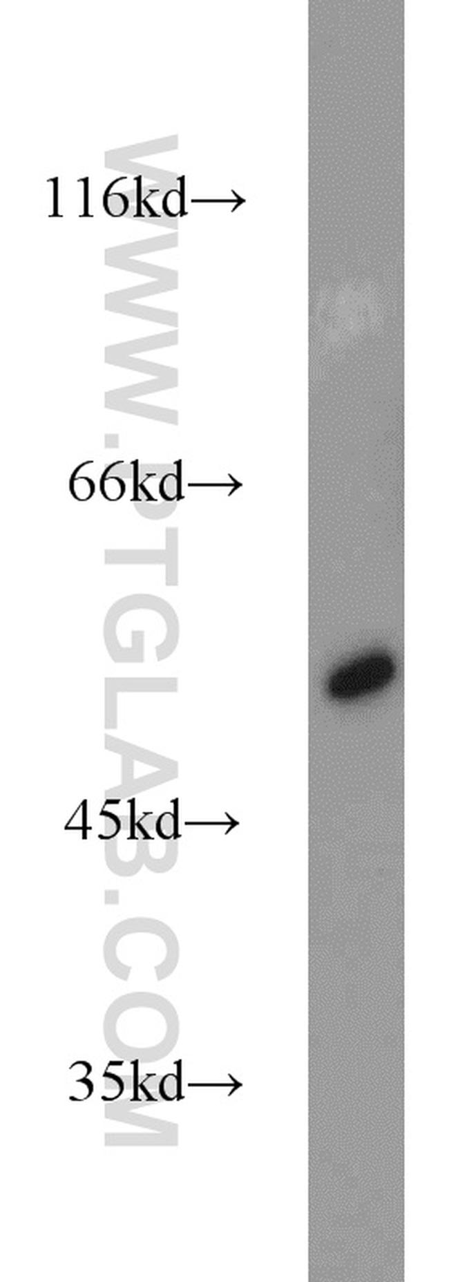 ALDH1B1 Antibody in Western Blot (WB)