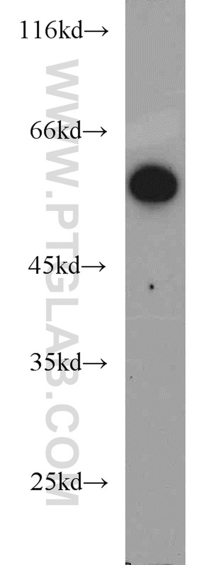 ALDH1B1 Antibody in Western Blot (WB)