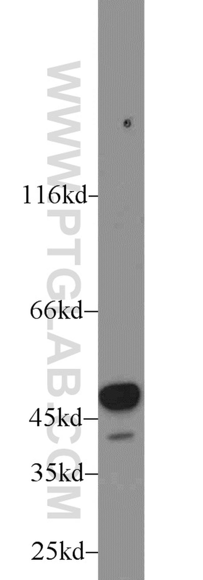 ALDH1B1 Antibody in Western Blot (WB)