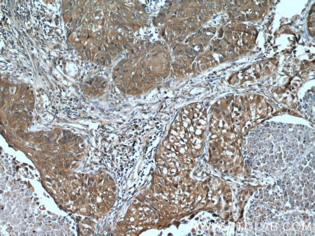 Cytokeratin 14 Antibody in Immunohistochemistry (Paraffin) (IHC (P))