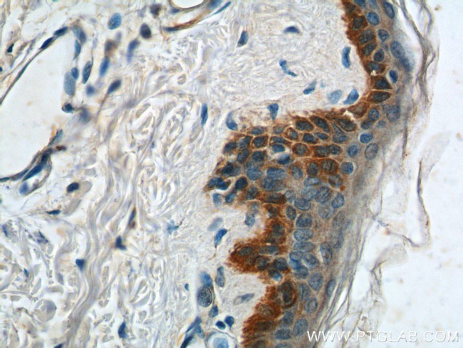 Cytokeratin 14 Antibody in Immunohistochemistry (Paraffin) (IHC (P))