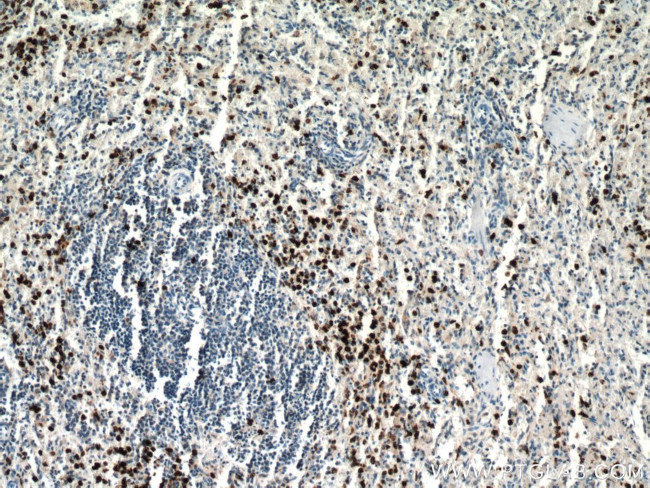 MPO Antibody in Immunohistochemistry (Paraffin) (IHC (P))