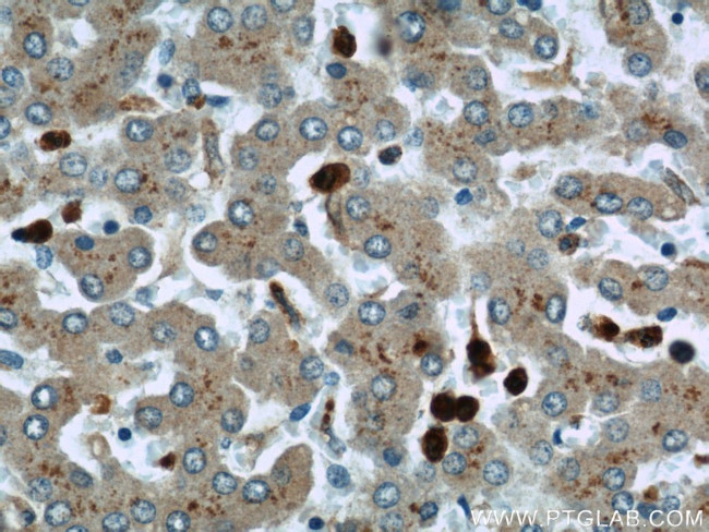 MPO Antibody in Immunohistochemistry (Paraffin) (IHC (P))