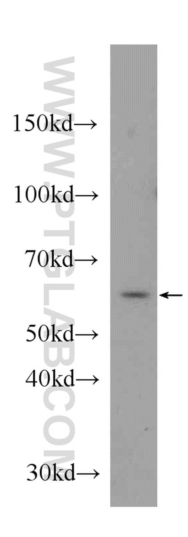 MPO Antibody in Western Blot (WB)