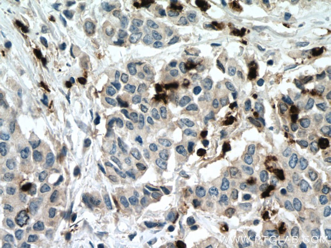 MPO Antibody in Immunohistochemistry (Paraffin) (IHC (P))