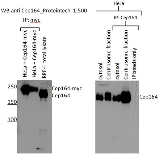 CEP164 Antibody in Immunoprecipitation (IP)