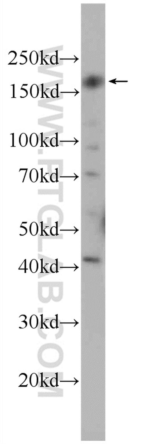CEP164 Antibody in Western Blot (WB)