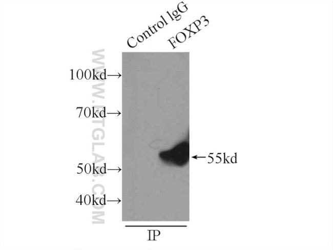 FOXP3 Antibody in Immunoprecipitation (IP)