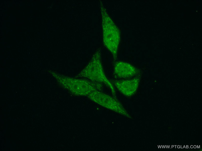 TIMM50 Antibody in Immunocytochemistry (ICC/IF)