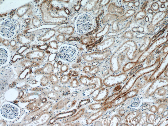 TIMM50 Antibody in Immunohistochemistry (Paraffin) (IHC (P))