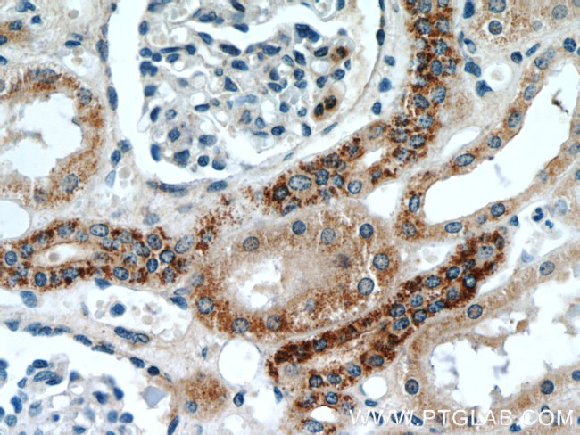 TIMM50 Antibody in Immunohistochemistry (Paraffin) (IHC (P))