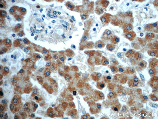 TIMM50 Antibody in Immunohistochemistry (Paraffin) (IHC (P))