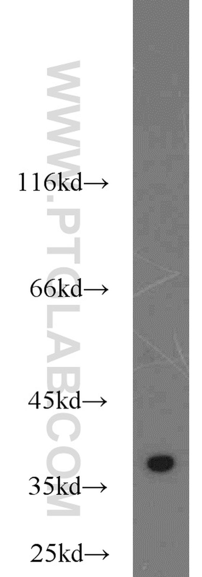 TIMM50 Antibody in Western Blot (WB)