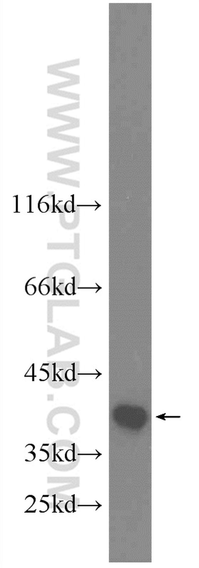 TIMM50 Antibody in Western Blot (WB)