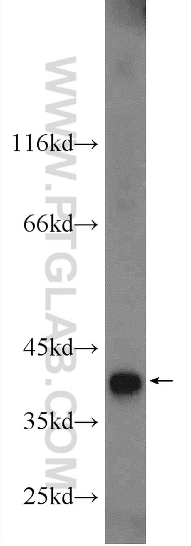 TIMM50 Antibody in Western Blot (WB)