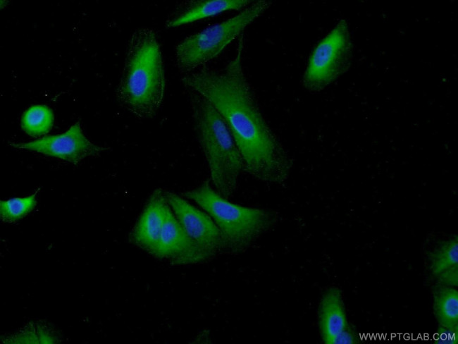 HIP1 Antibody in Immunocytochemistry (ICC/IF)