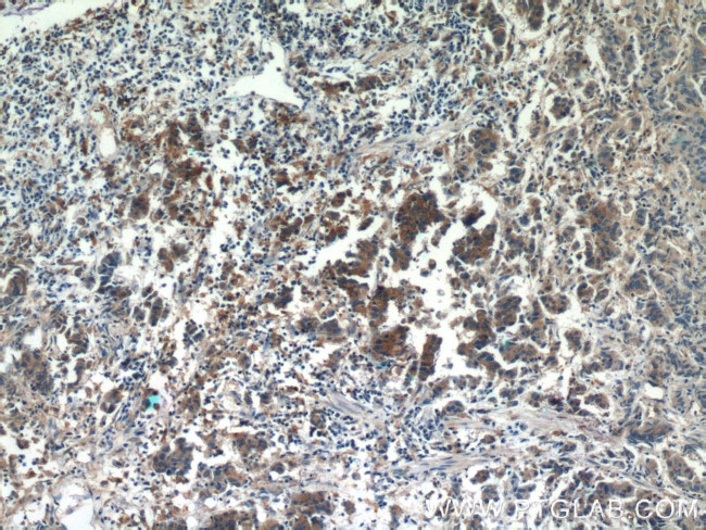 HIP1 Antibody in Immunohistochemistry (Paraffin) (IHC (P))