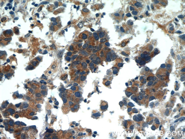 HIP1 Antibody in Immunohistochemistry (Paraffin) (IHC (P))