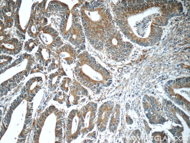 HIP1 Antibody in Immunohistochemistry (Paraffin) (IHC (P))