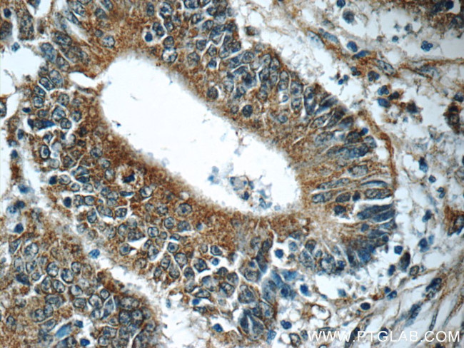 HIP1 Antibody in Immunohistochemistry (Paraffin) (IHC (P))