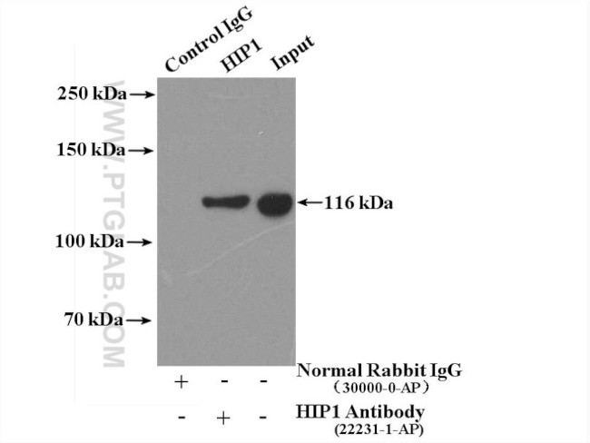 HIP1 Antibody in Immunoprecipitation (IP)