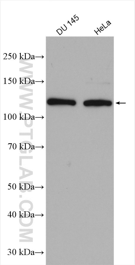 HIP1 Antibody in Western Blot (WB)