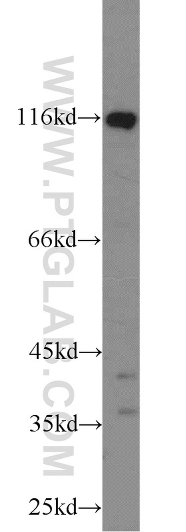 HIP1 Antibody in Western Blot (WB)