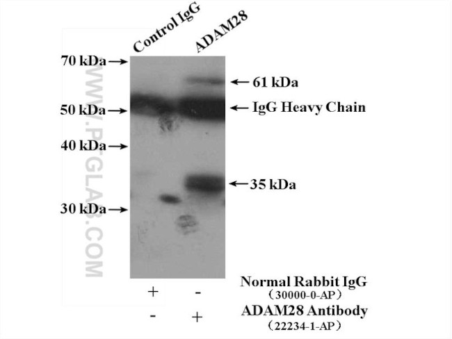 ADAM28 Antibody in Immunoprecipitation (IP)