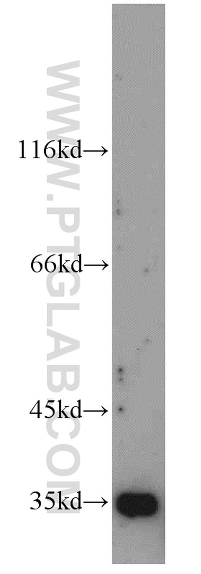 ADAM28 Antibody in Western Blot (WB)