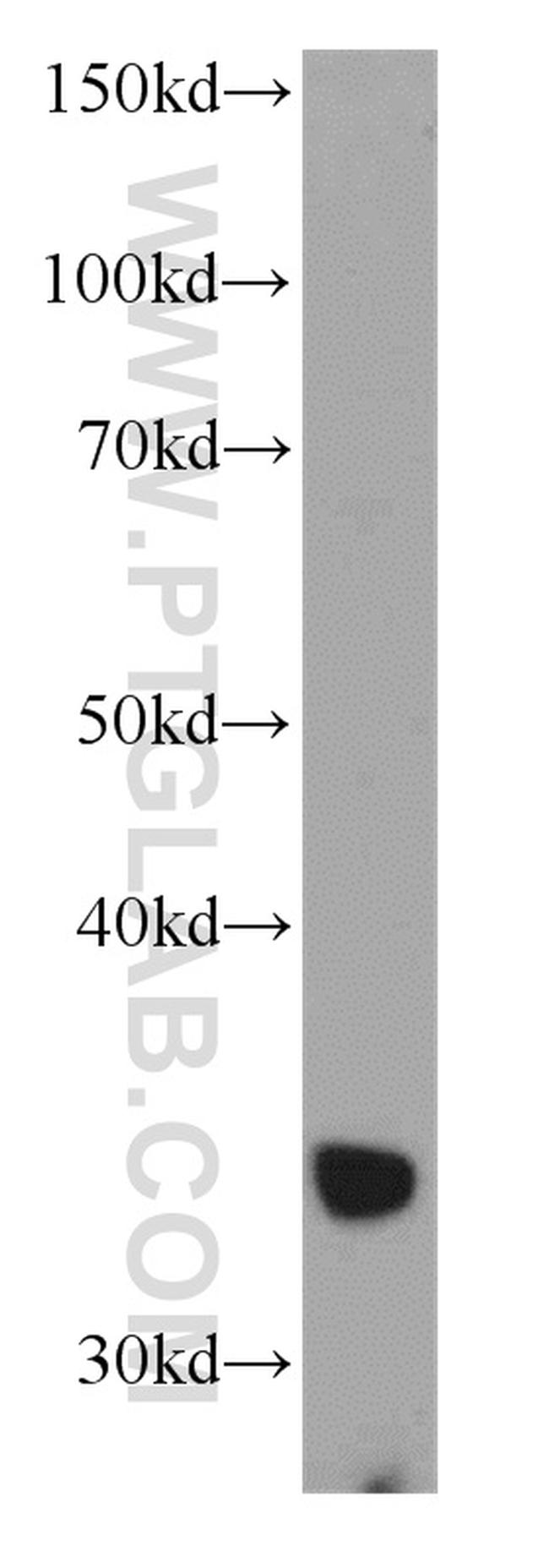 ADAM28 Antibody in Western Blot (WB)