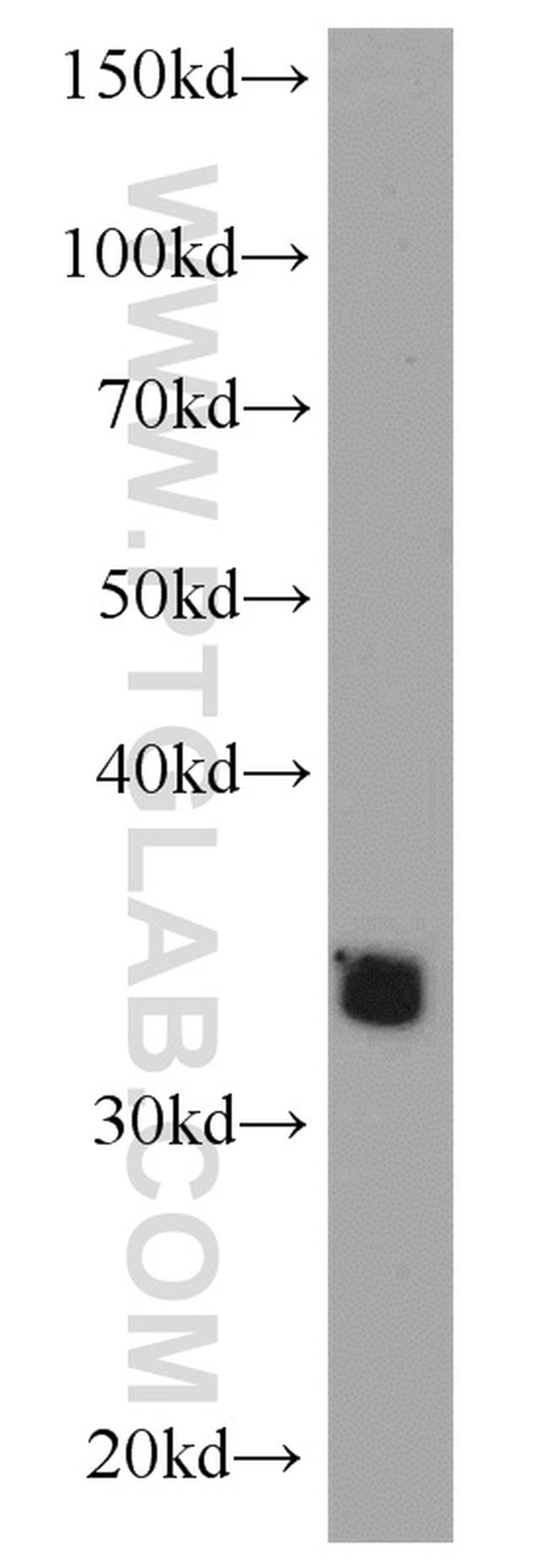 ADAM28 Antibody in Western Blot (WB)