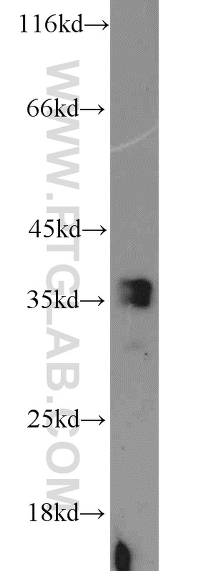 ADAM28 Antibody in Western Blot (WB)