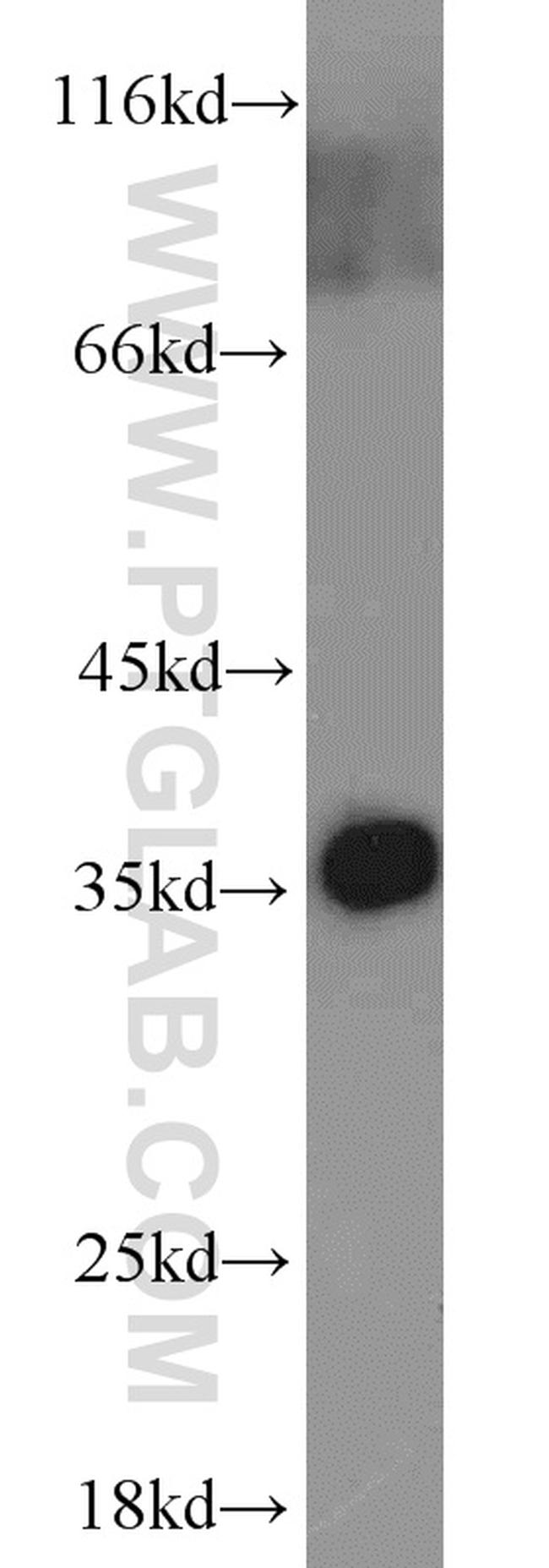 ADAM28 Antibody in Western Blot (WB)