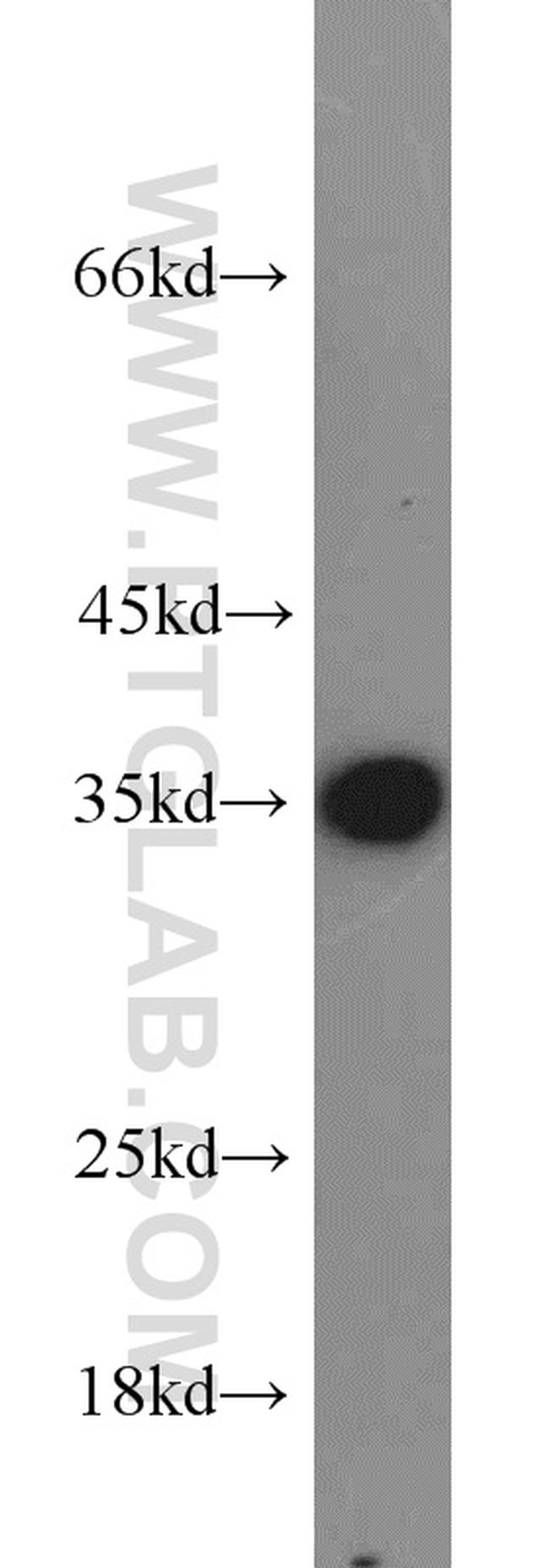 ADAM28 Antibody in Western Blot (WB)