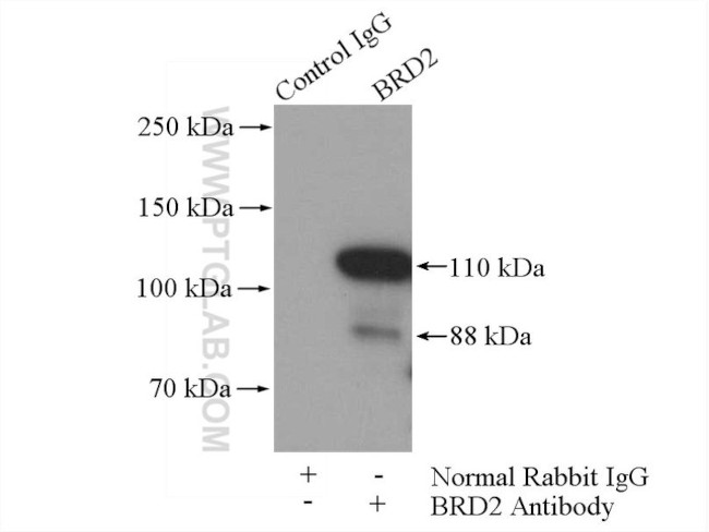 BRD2 Antibody in Immunoprecipitation (IP)