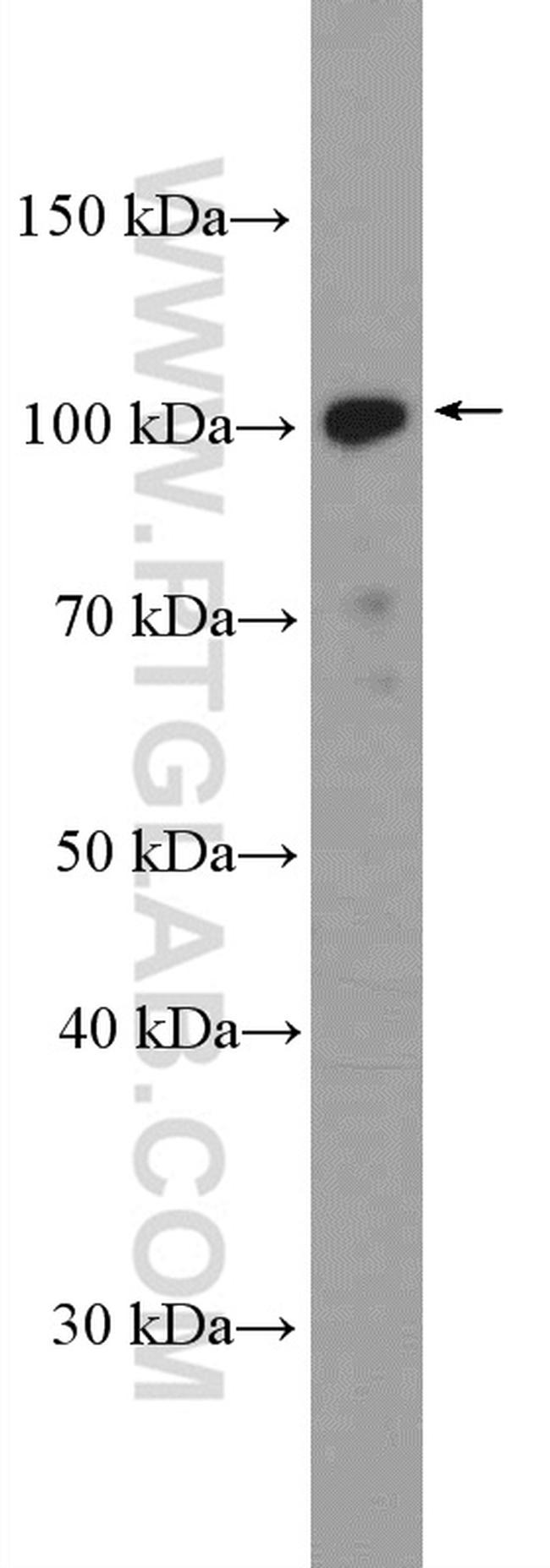 BRD2 Antibody in Western Blot (WB)