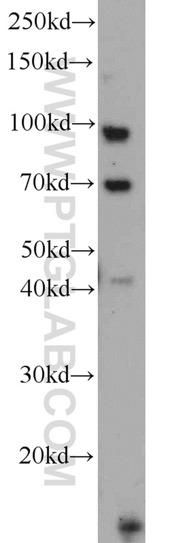 TLR6 Antibody in Western Blot (WB)