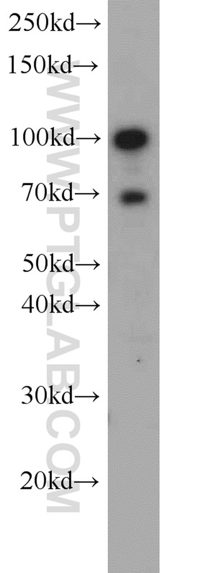 TLR6 Antibody in Western Blot (WB)