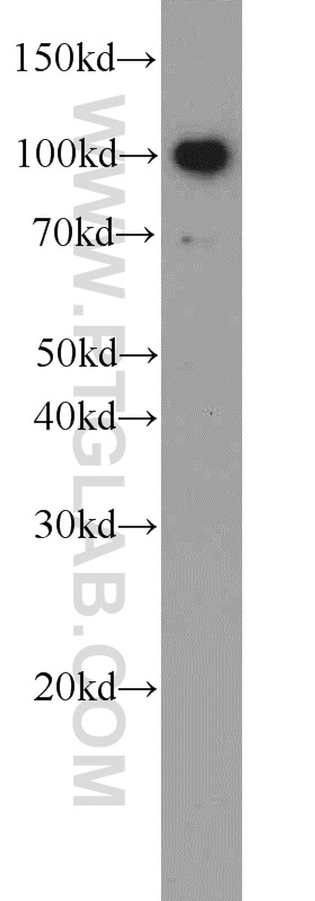 TLR6 Antibody in Western Blot (WB)