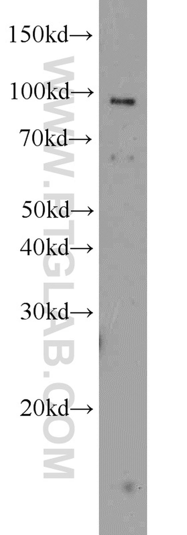 TLR6 Antibody in Western Blot (WB)