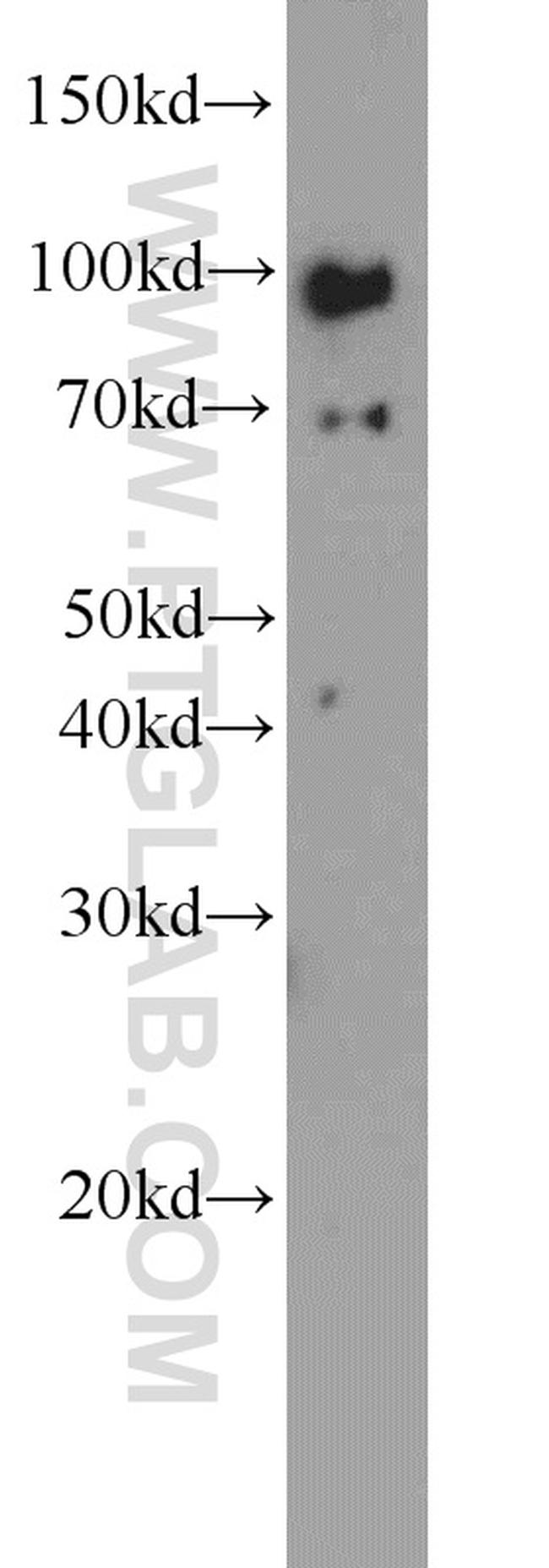 TLR6 Antibody in Western Blot (WB)