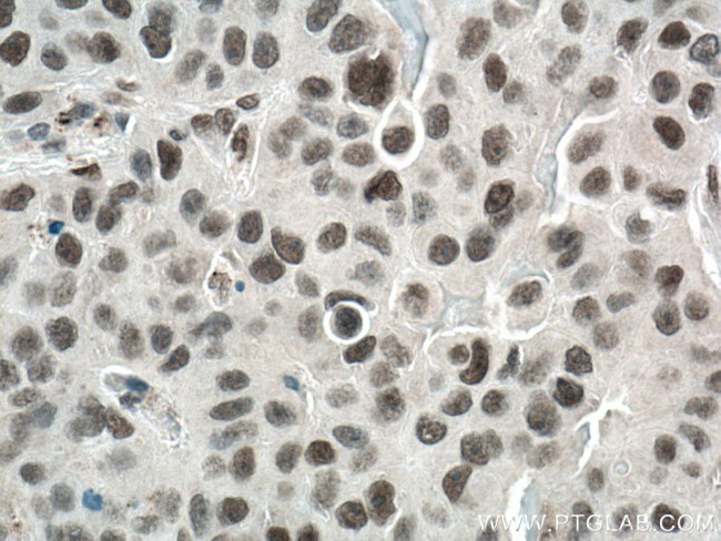 REST Antibody in Immunohistochemistry (Paraffin) (IHC (P))