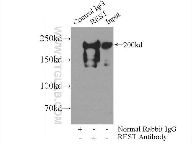 REST Antibody in Immunoprecipitation (IP)